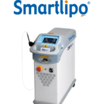 smartlipo laser lipolisis lipo laser DEKA