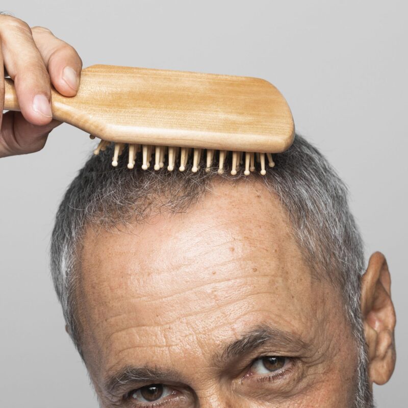 Trasplante de Pelo Asistido por Láser