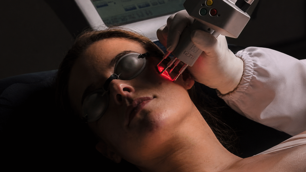 Laser CO2 para clínicas dermatológicas