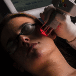 Laser CO2 para clínicas dermatológicas