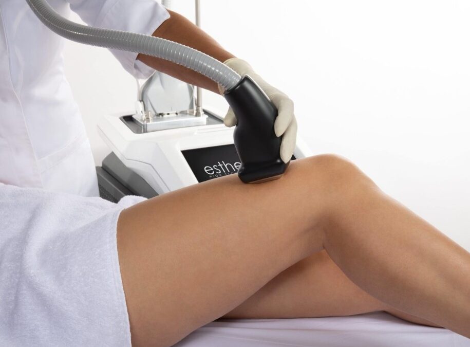 smartepil laser depilacion diodo DEKA