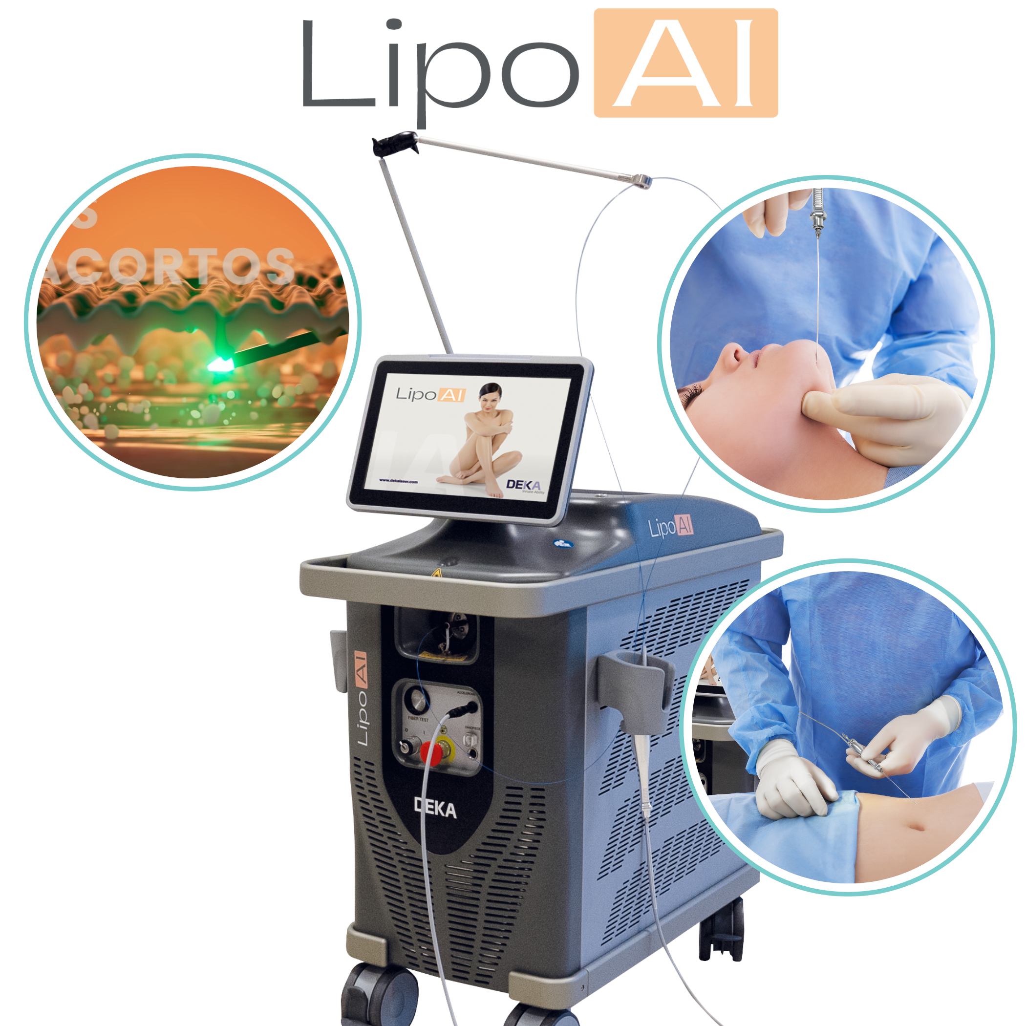 LIPO AI | Láserlipólisis y Liposucción Asistida por Láser para Clínicas